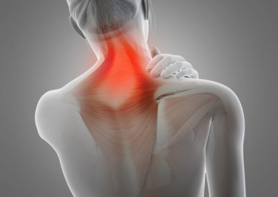Fixing neck and shoulder pain at Somerville Physiotherapy